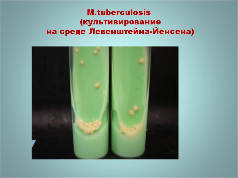 M.tuberculosis   (культивирование  на среде Левенштейна-Йенсена)